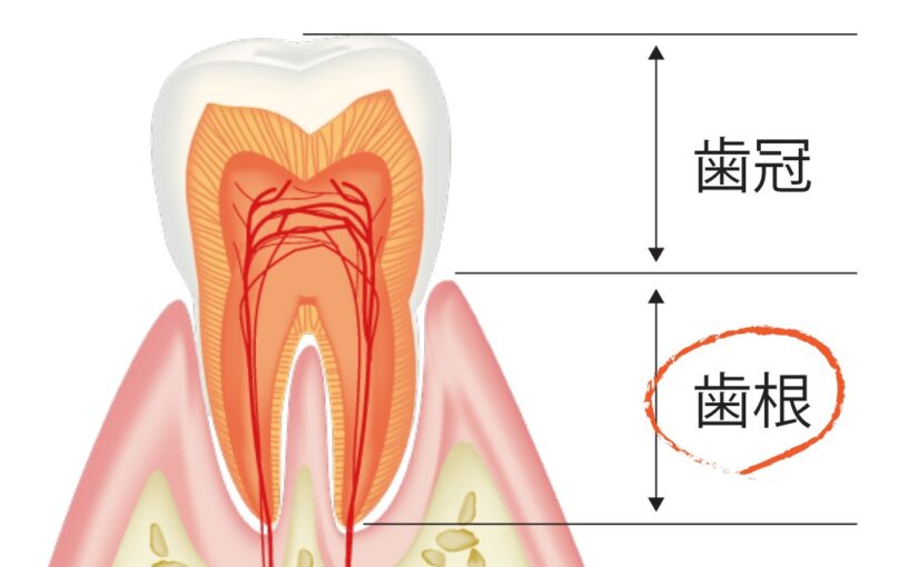 【歯の構造】歯根内部編：根管治療に時間がかかる理由